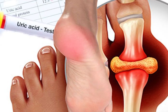 uric acid